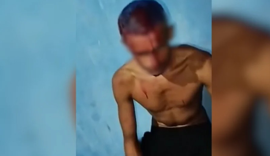 “Quem procura acha”: achou que ia fazer mulher de corna, foi desmascarado e levou surra no Pará